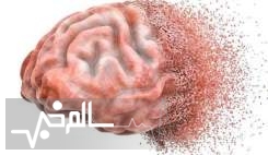 آهسته راه رفتن نشانه ابتلا به زوال عقل است