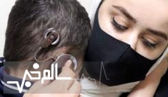 سالانه ۲ هزار بیمار خدمات کاشت حلزون دریافت می‌کنند