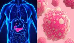 توسعه ایمپلنت دارورسان برای درمان سرطان خاموش پانکراس